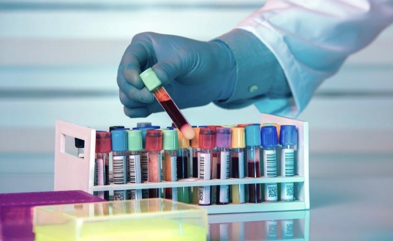 Egyptian Armed Forces Establishes Its First Automated Biobank