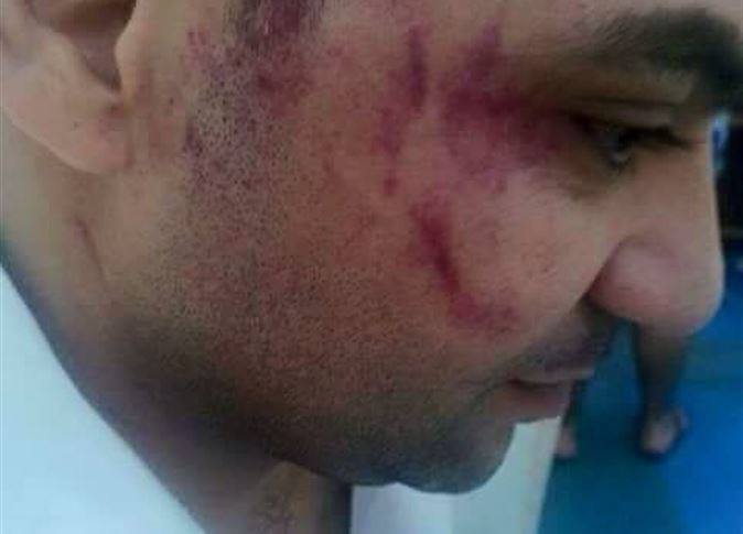 VIDEO: Egyptian Waiter Attacked by Jordanian MP's Entourage