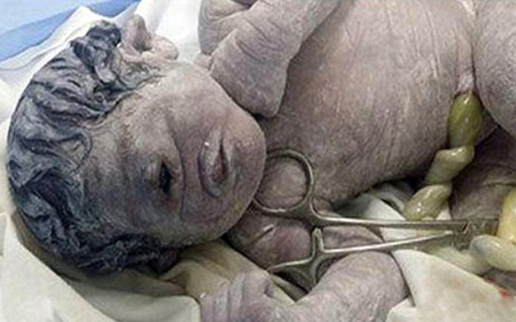 Mythical Baby Cyclops Born in Egypt