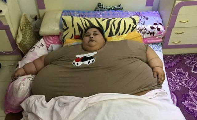 Morbidly Obese and Bedridden Egyptian Woman Calls for Help on Facebook
