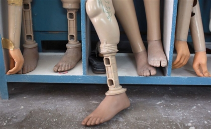 New Industrial Complex to Produce Prosthetics & Artificial Limbs